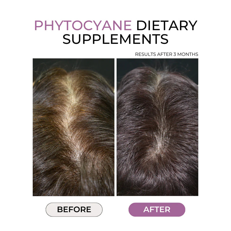 Phyto - PhytoCyane Anti Hair Loss Food Supplement 84 Capsules