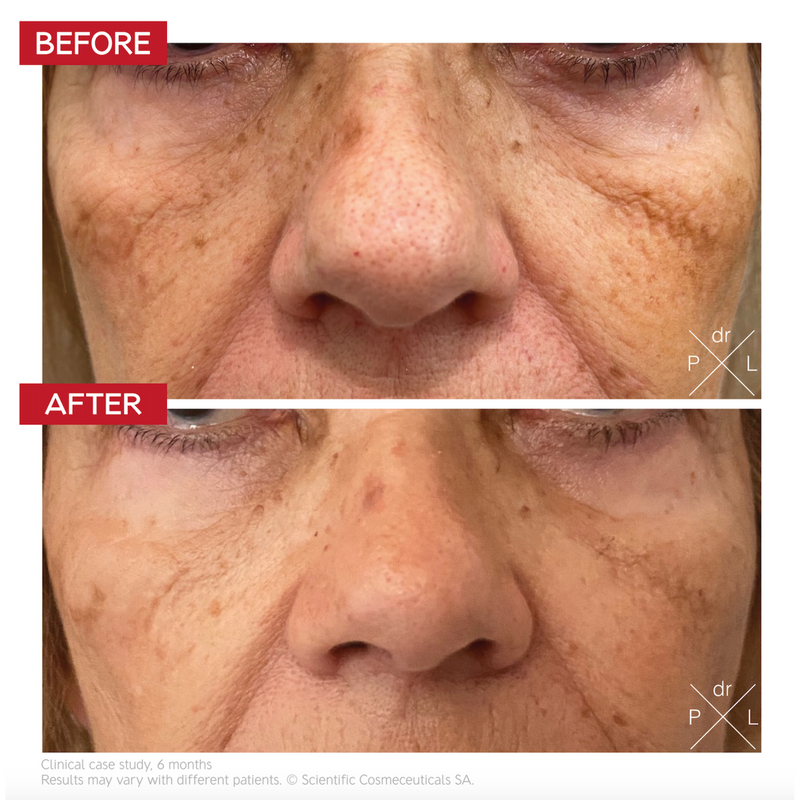 Dr Levy - Pigment Control Drops 30ml