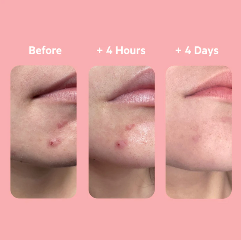 SVR - Sebiaclear Gel Flash 4H 15ml