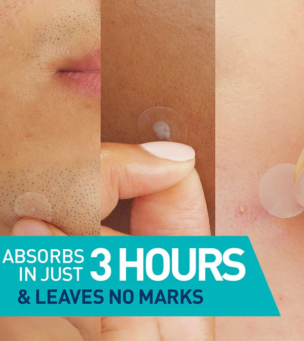 CeraVe - Blemish Barrier 22 Patches