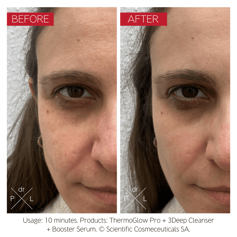 Dr Levy - The Thermoglow Pro