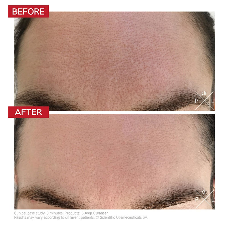 Dr Levy -  3DEEP™ Cleanser - FastMask™Cleanser 150ml
