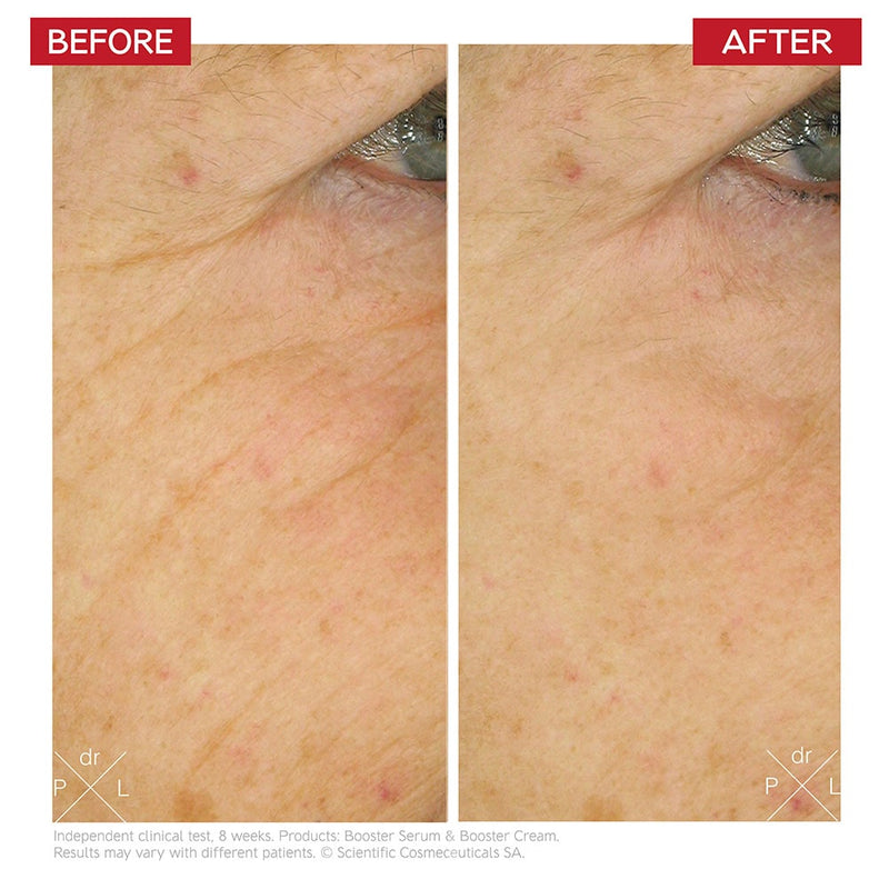Dr Levy - Intense Stem Cell Booster Cream 50ml