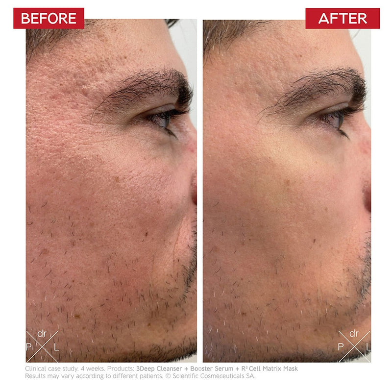 Dr Levy - Intense Stem Cell Booster Serum 30ml