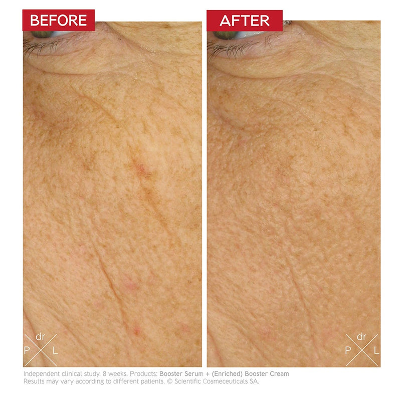 Dr Levy - Intense Stem Cell Enriched Booster Cream 50ml