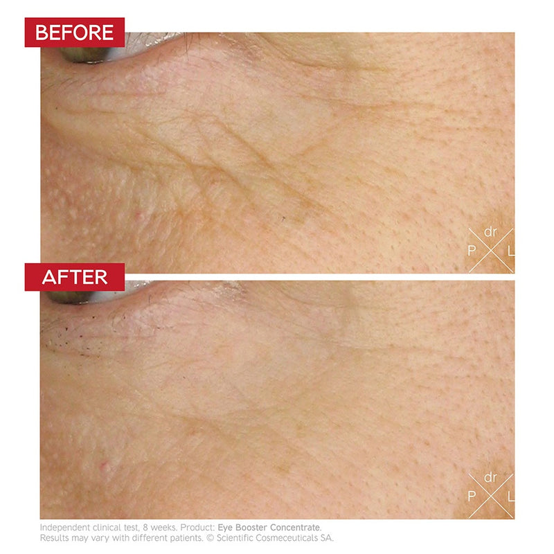 Dr Levy - Intense Stem Cell Eye Booster Concentrate 15ml