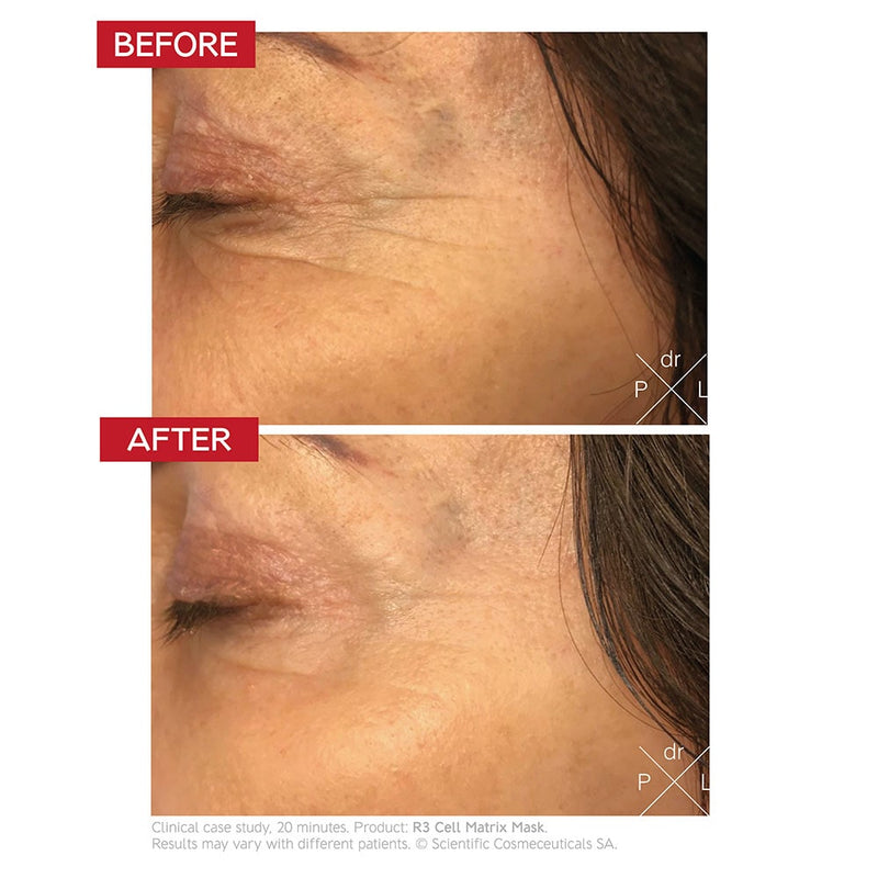 Dr Levy - R3 Cell Matrix Mask 50ml