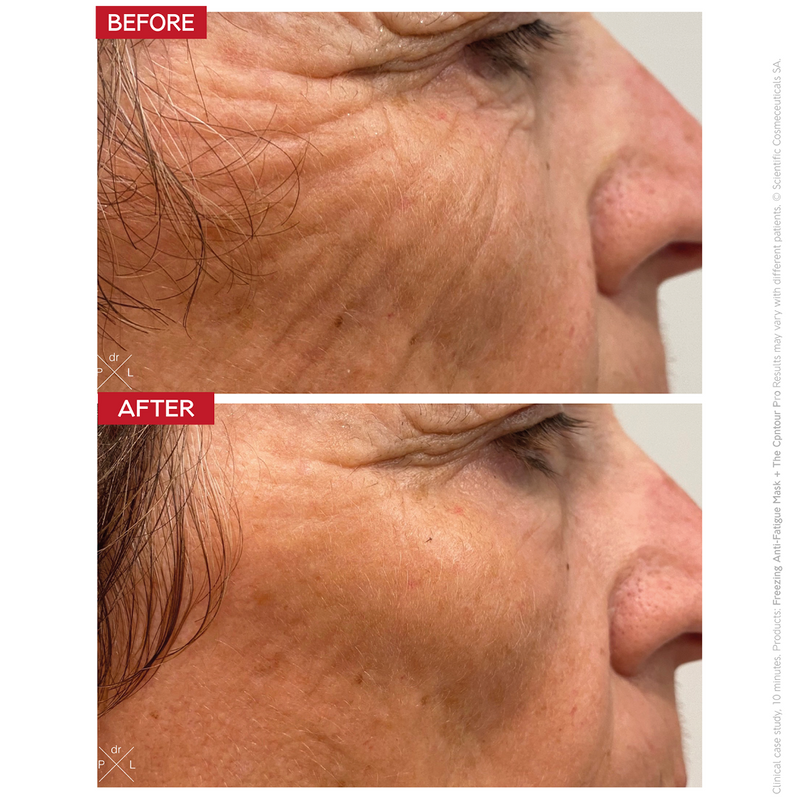 Dr Levy - The Contour Pro