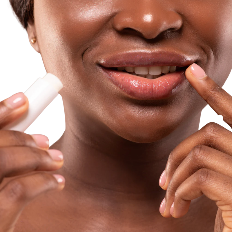 SVR - Topialyse Lip Balm 4.8g